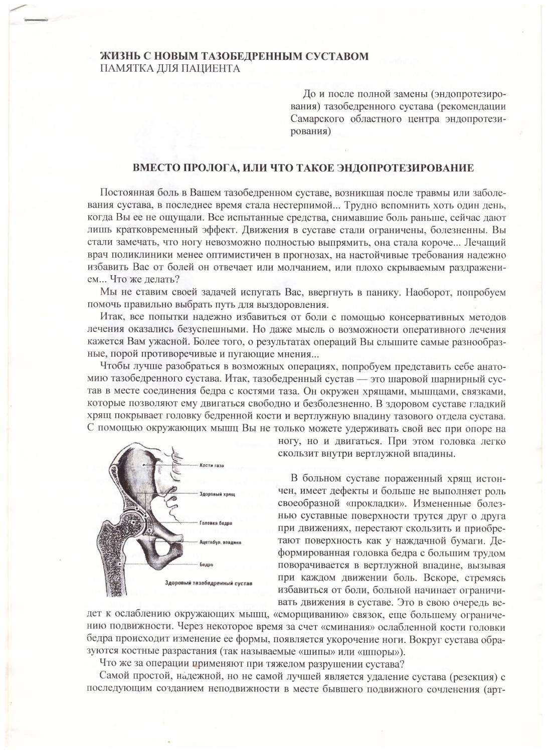 Памятка пациентам тазобедренных суставов Памятка пациентам тазобедренных суставов
